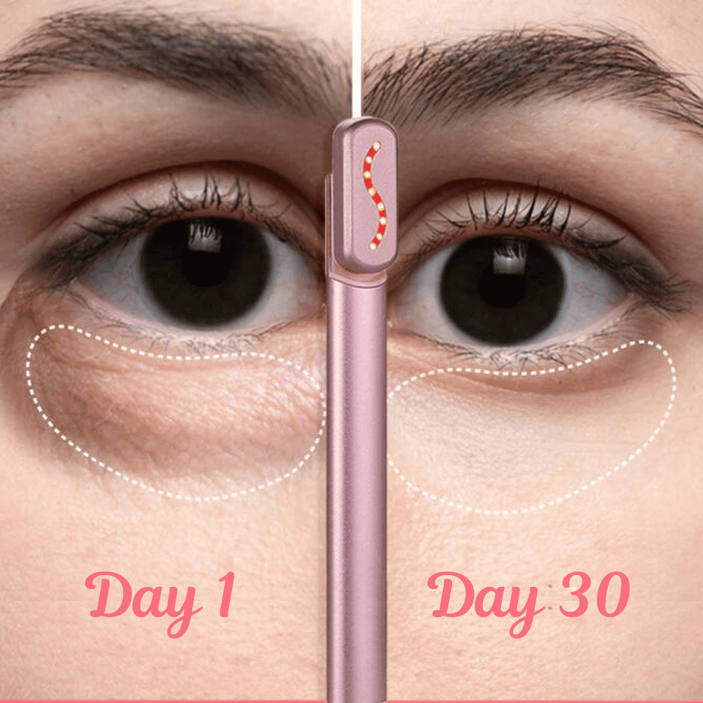 4-in-1 MySkinix Skincare Wand