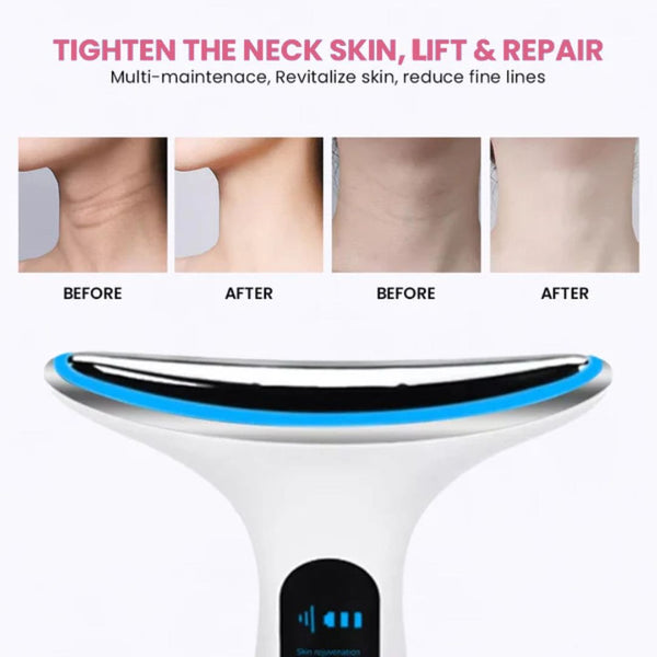 Myskinix Neck Lifting and Tightening Device