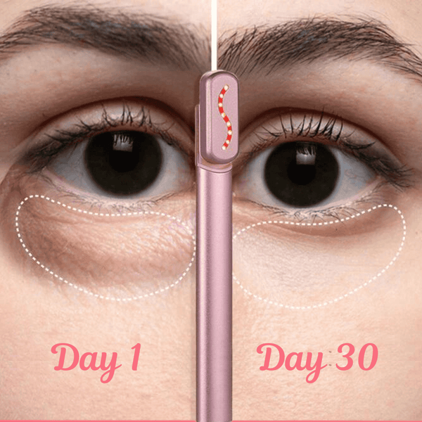 4-in-1 MySkinix Skincare Wand