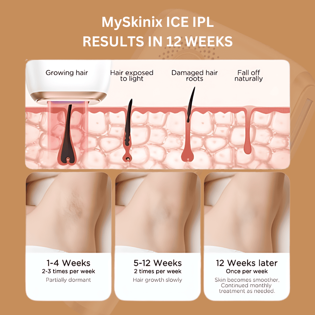 MySkinix Ice Cool Ipl Laser Device - MySkinix